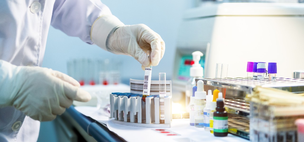 Featured image for “How to Ensure High-Quality Nucleic Acid Extractions – A Quick Overview”