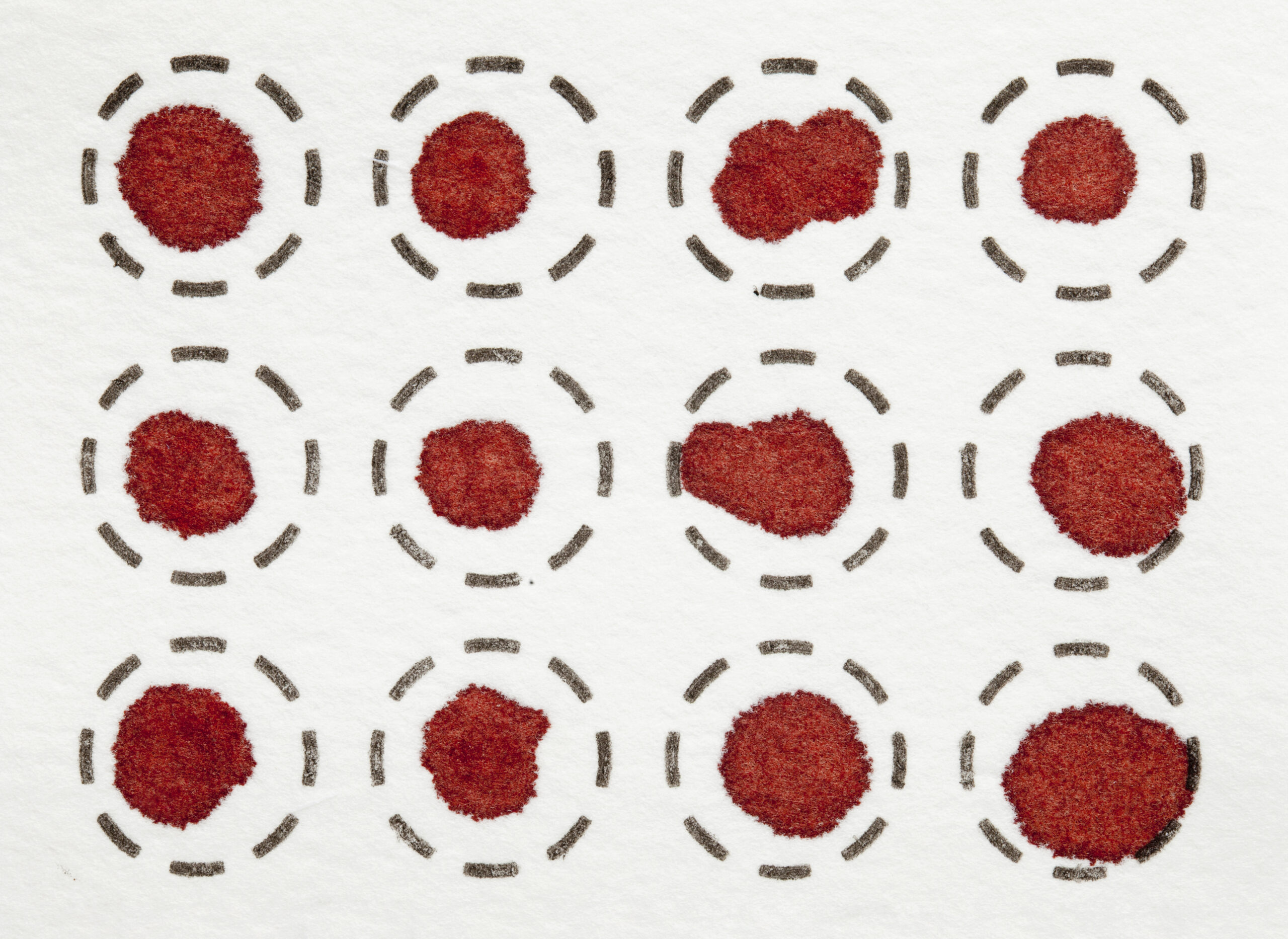 autogen workflows for Dried Blood Spots